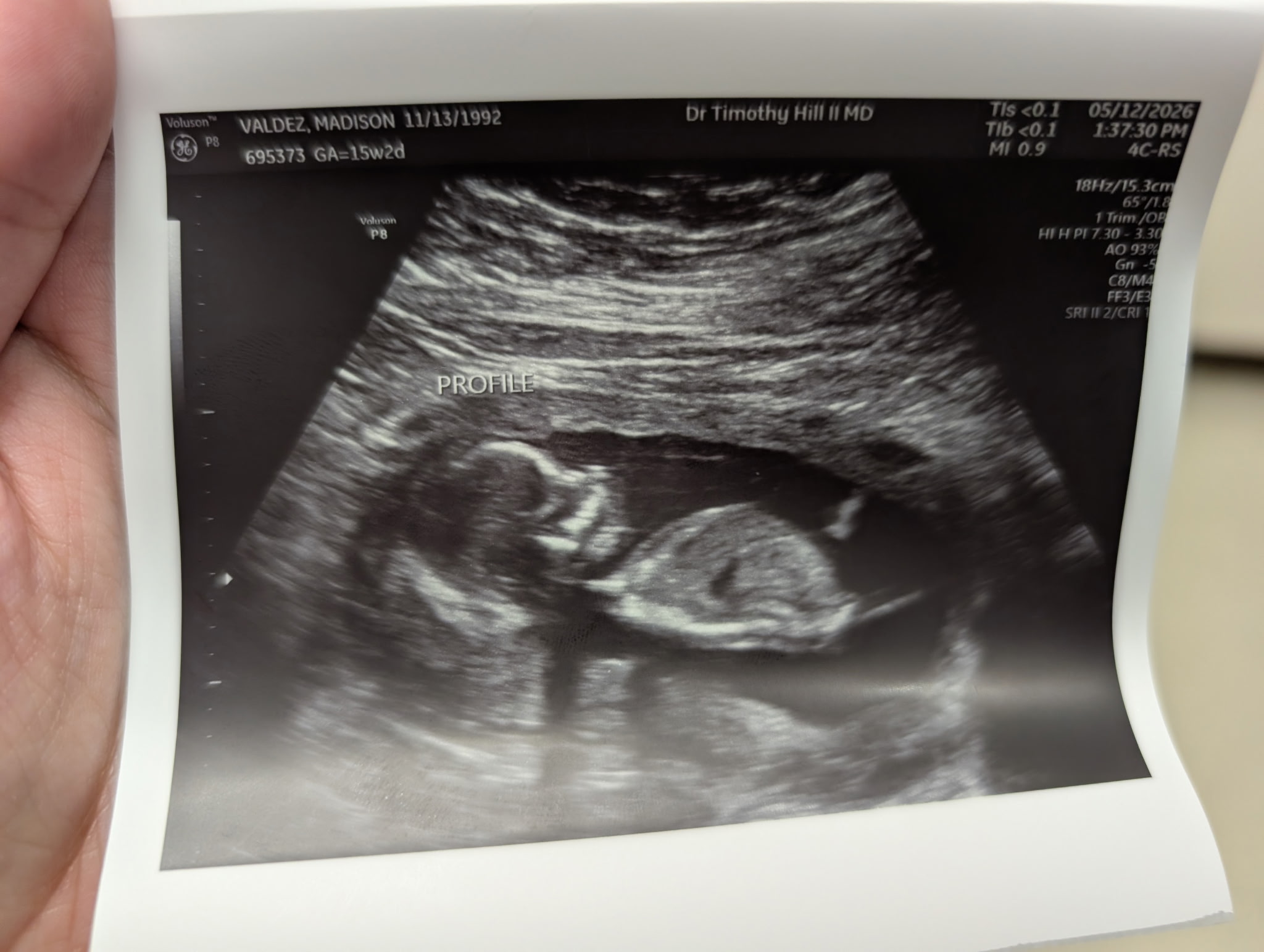 Madelynne ultrasound profile at 15 weeks